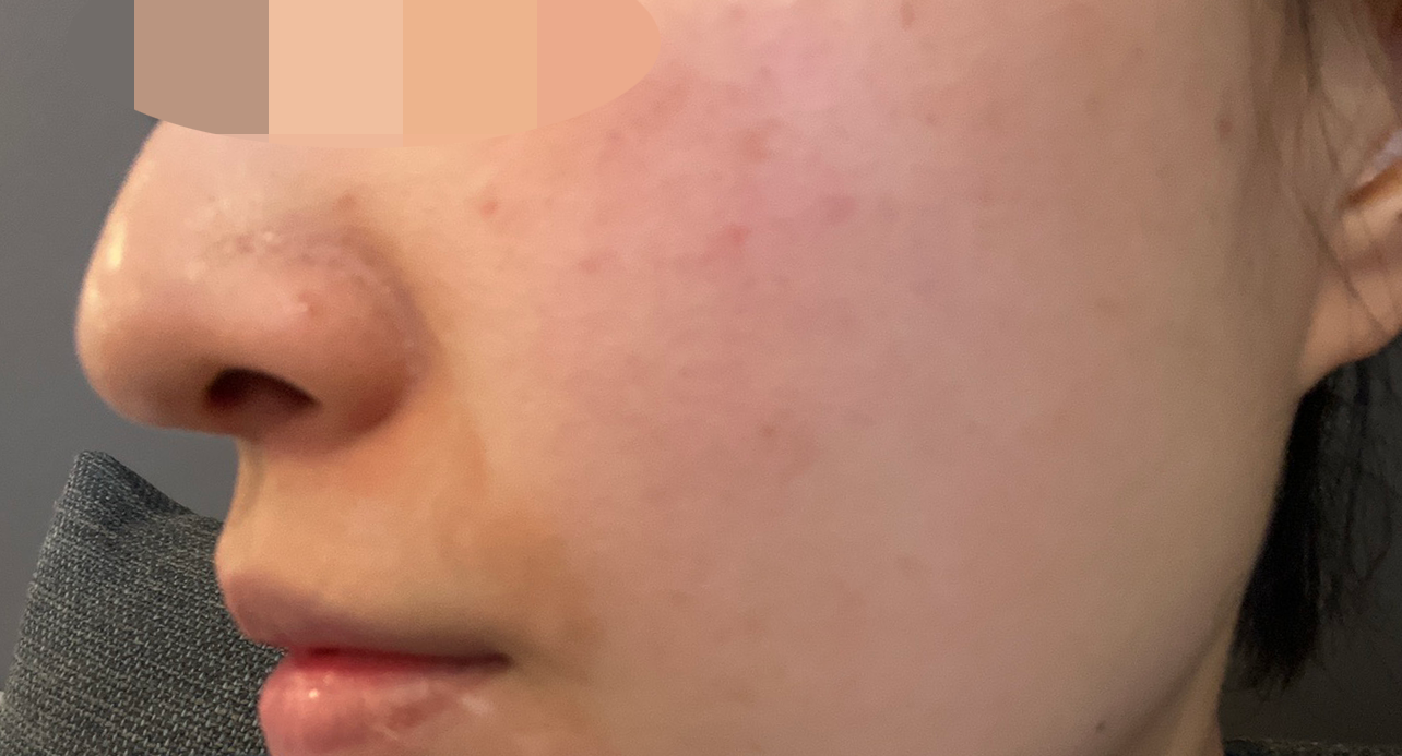 수술후기이미지