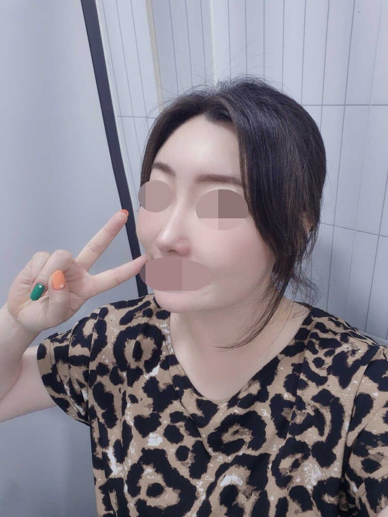 수술후기이미지