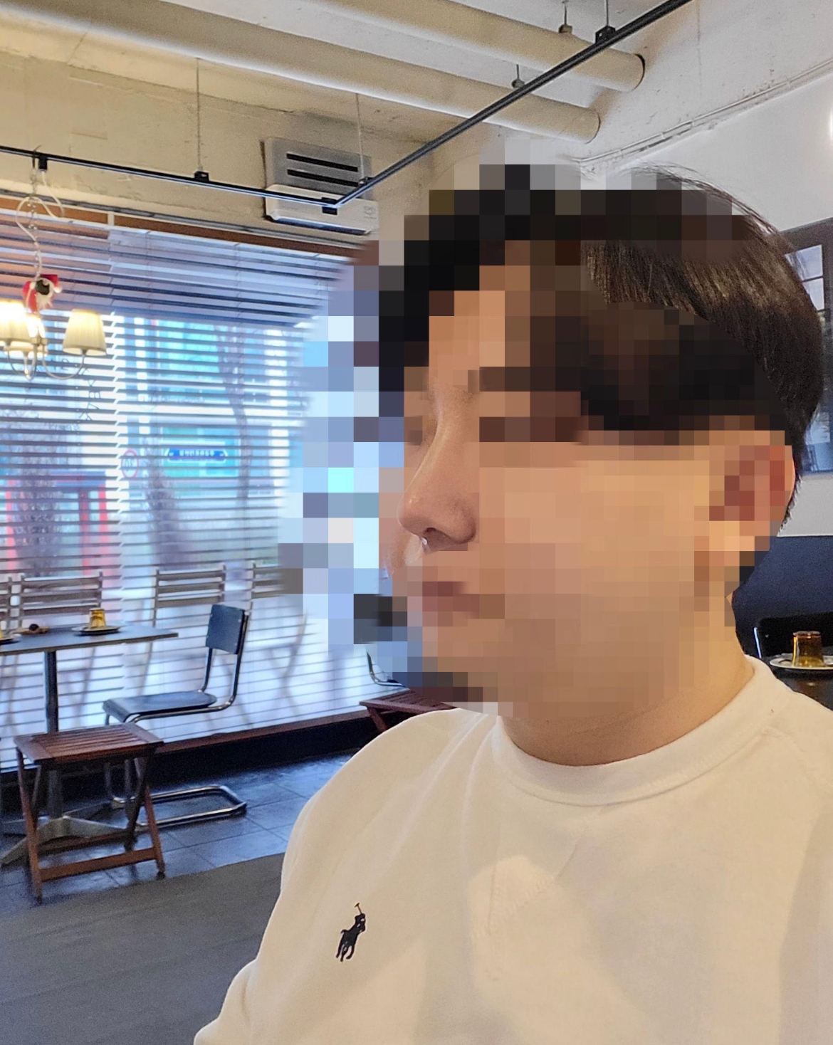 수술후기이미지