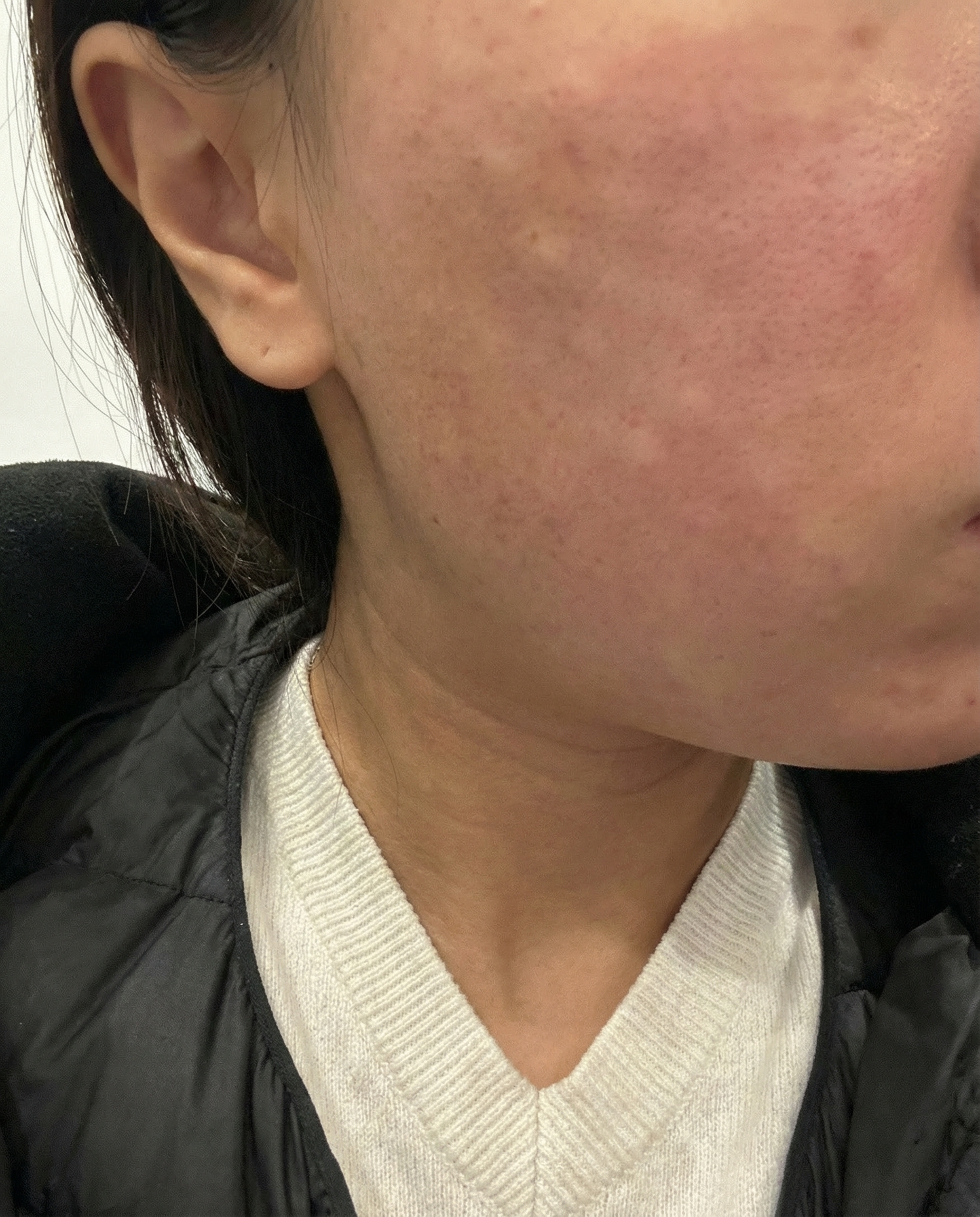 수술후기이미지