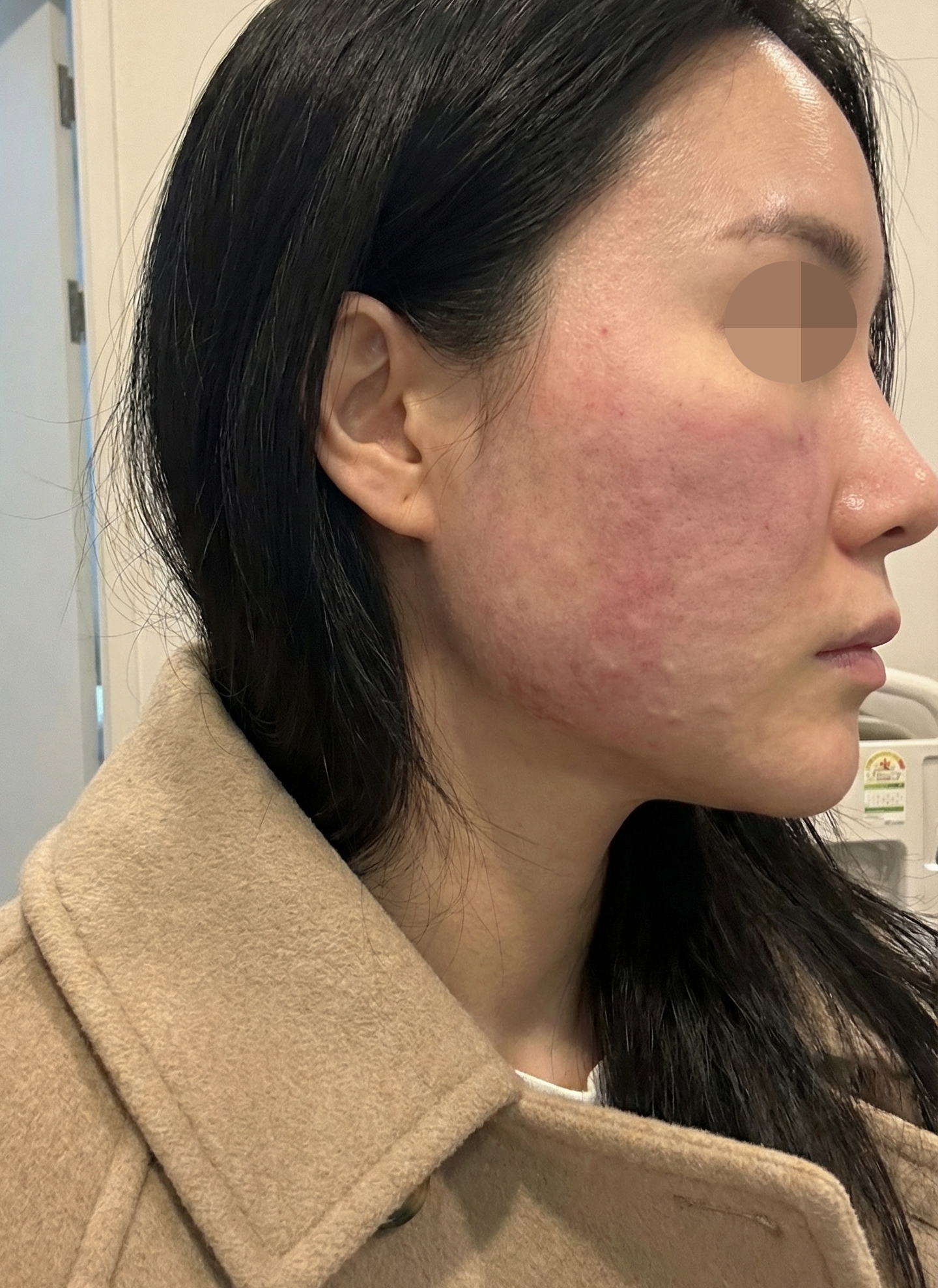 수술후기이미지