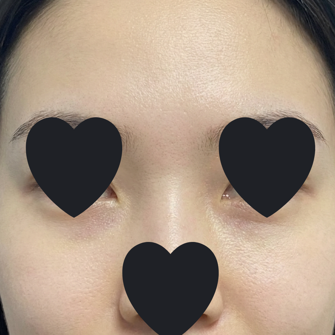 수술후기이미지
