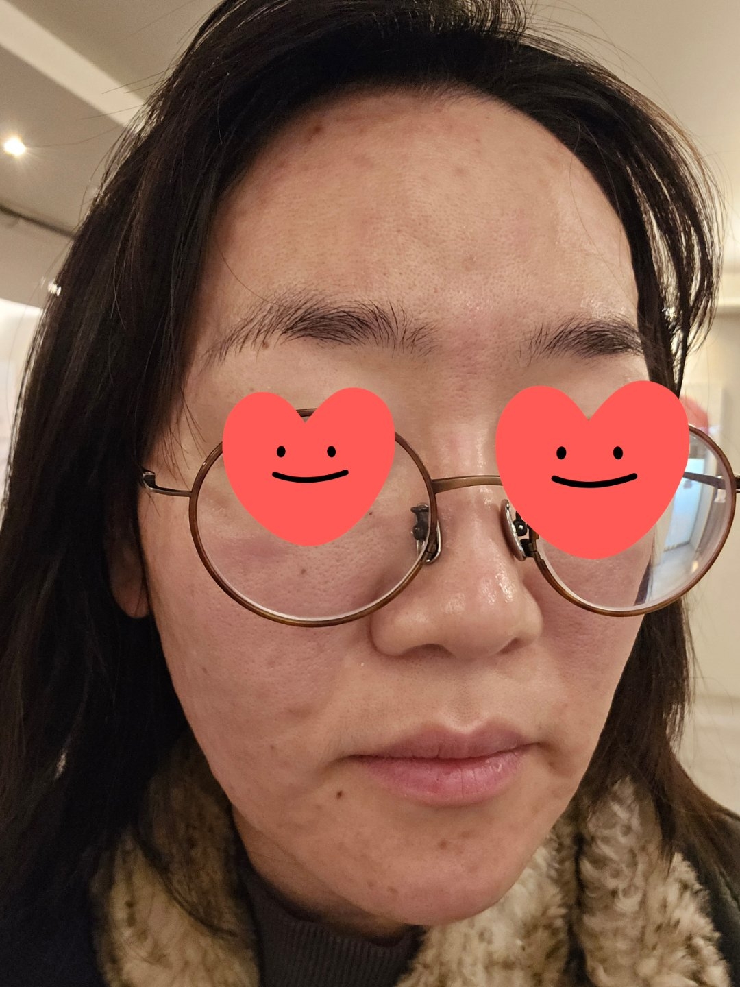 수술후기이미지