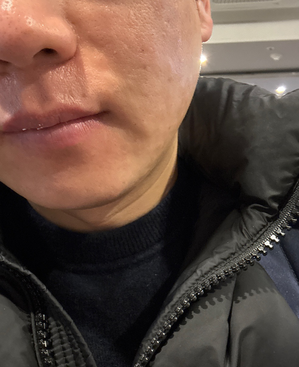 수술후기이미지