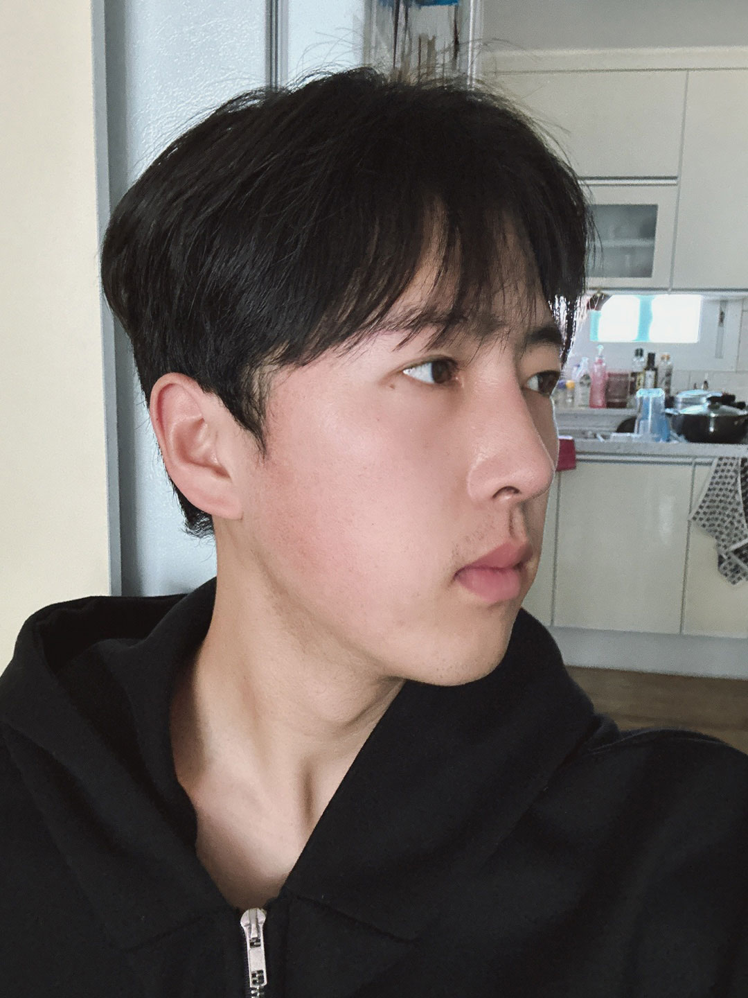 수술후기이미지