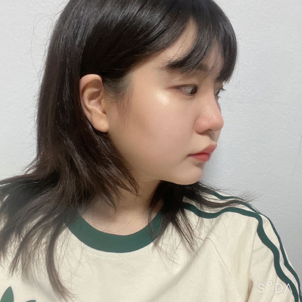 수술후기이미지