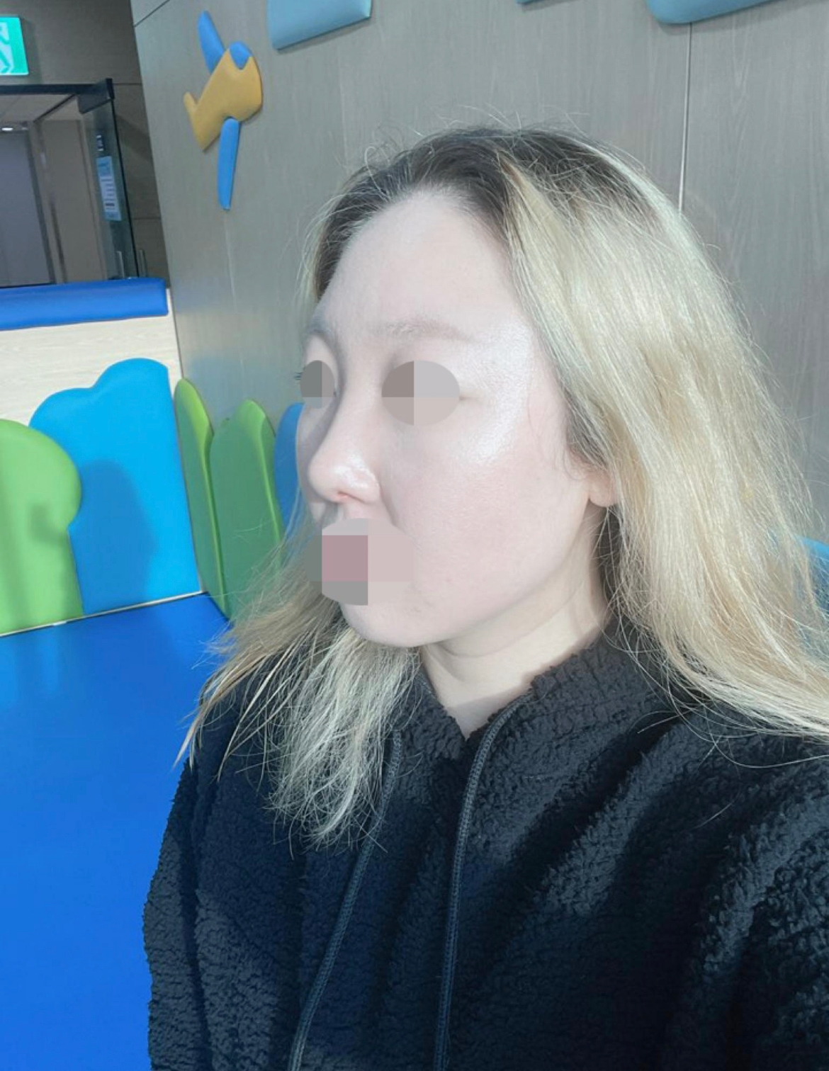 수술후기이미지