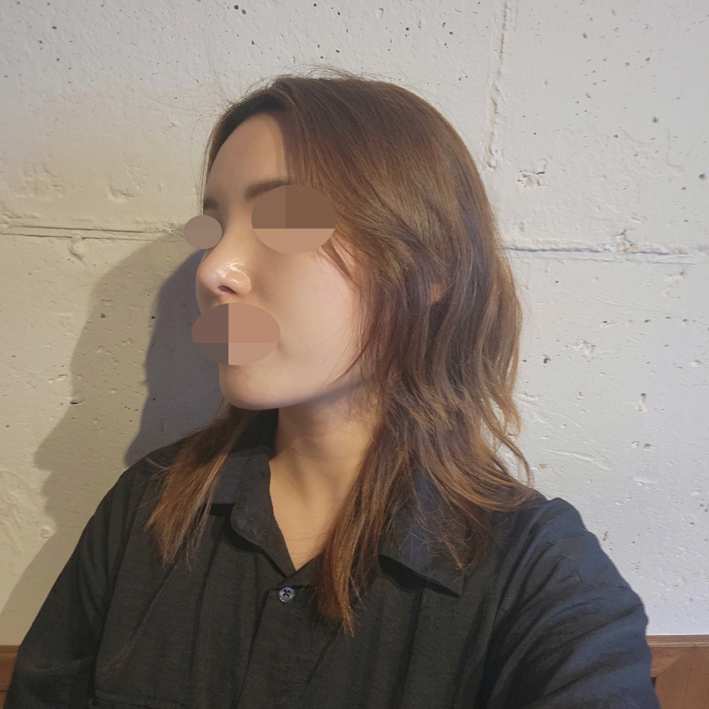 수술후기이미지