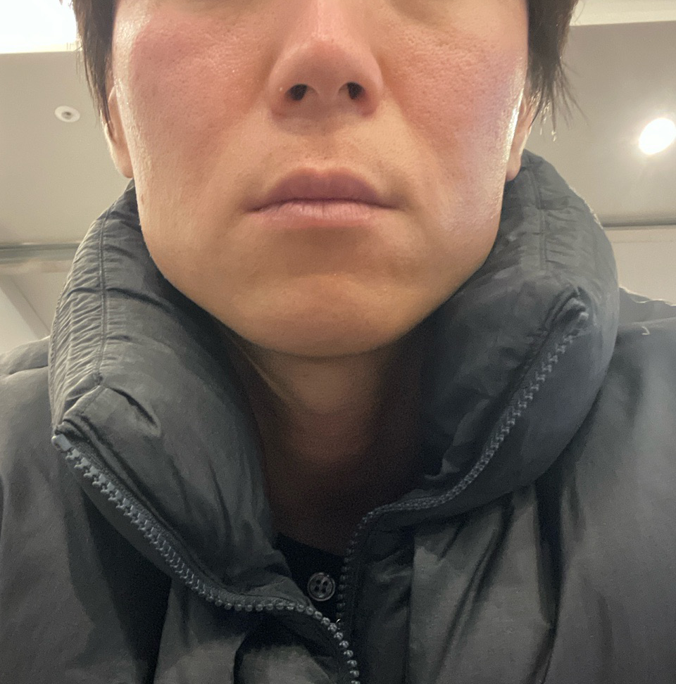 수술후기이미지