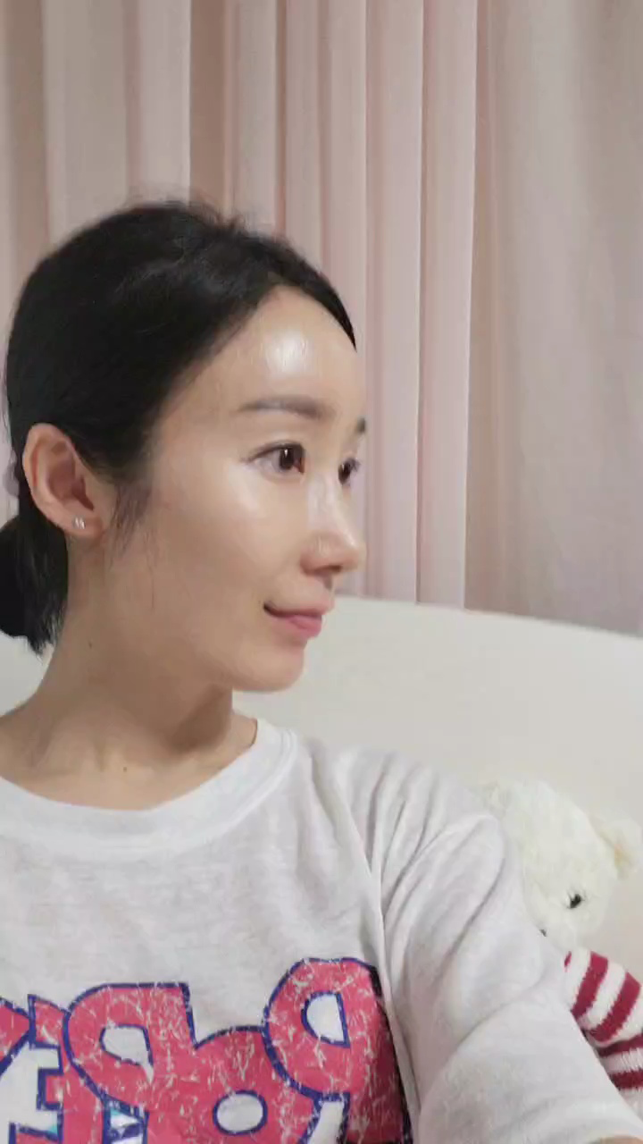 수술후기이미지