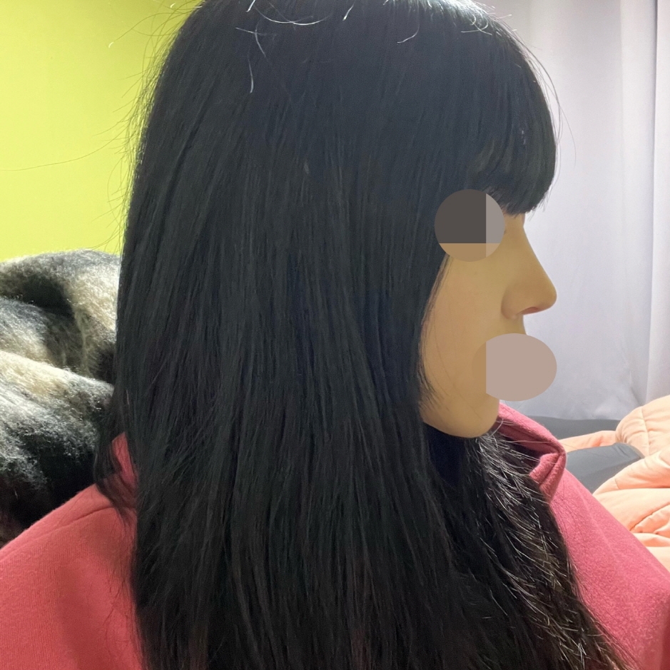 수술후기이미지