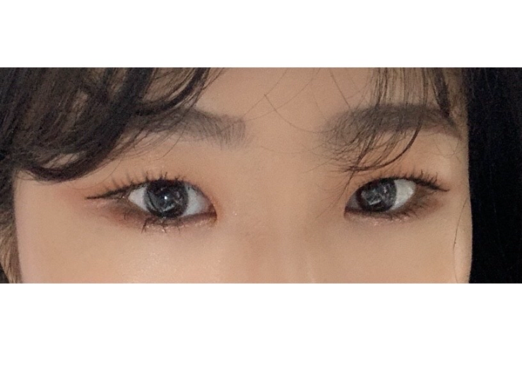 수술후기이미지