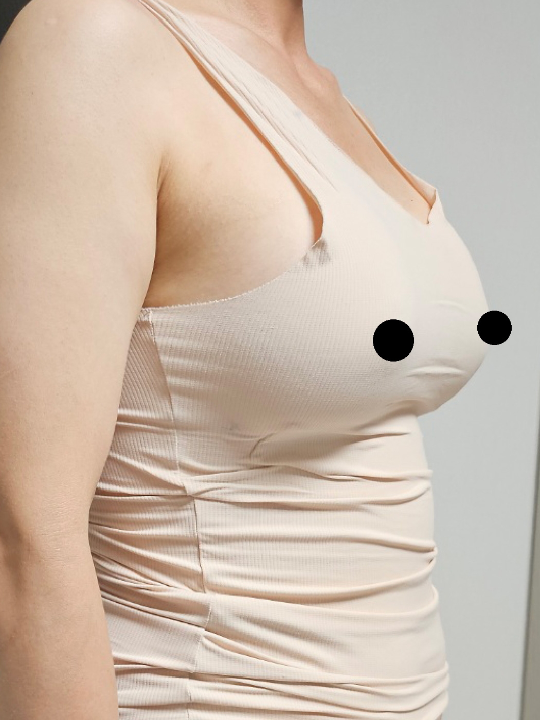 수술후기이미지