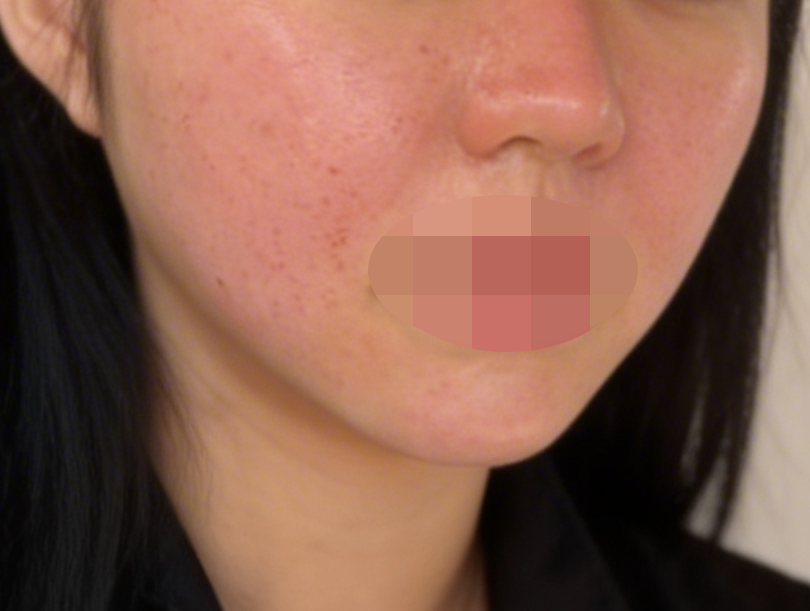 수술후기이미지