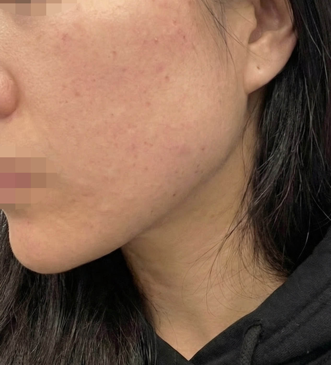 수술후기이미지