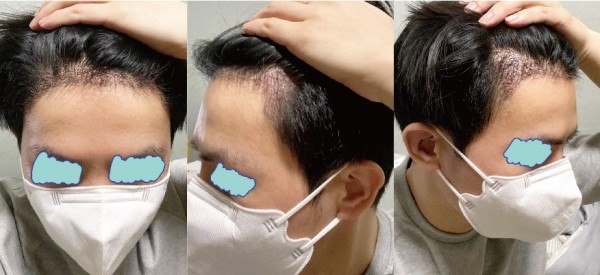 수술후기이미지