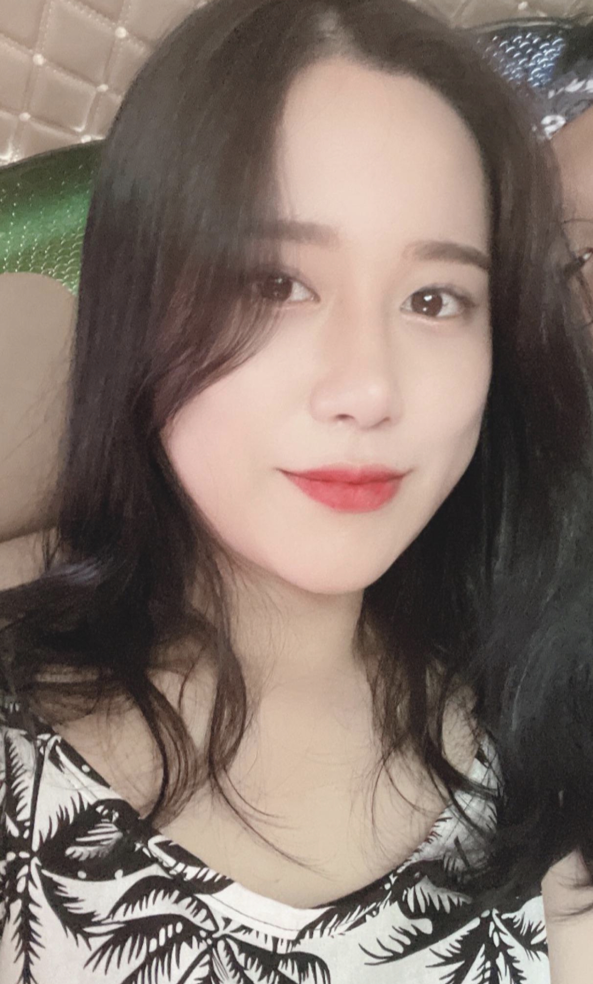 수술후기이미지