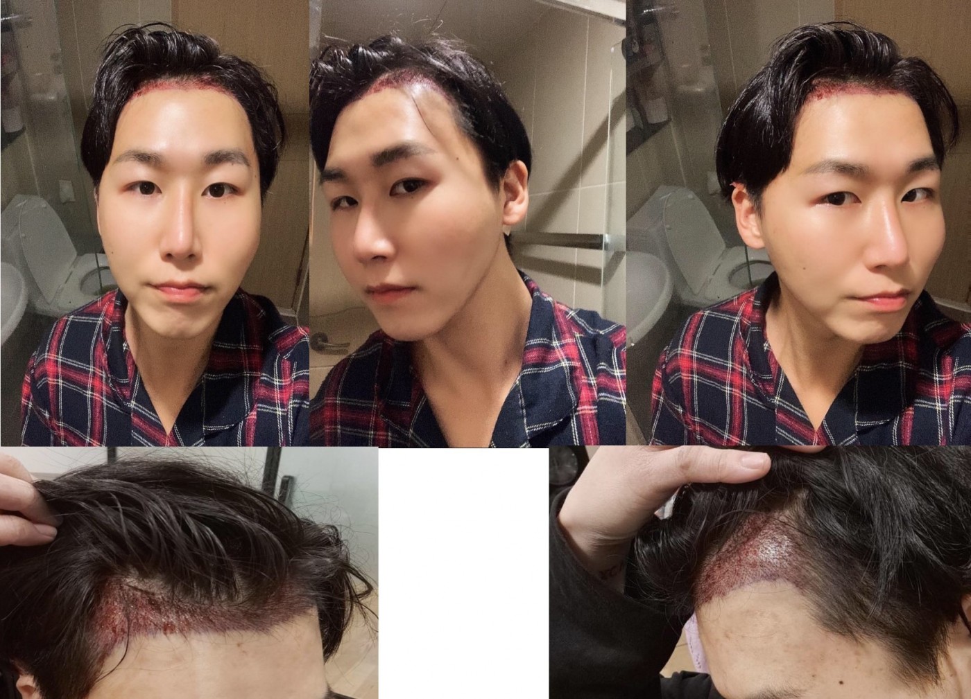 수술후기이미지