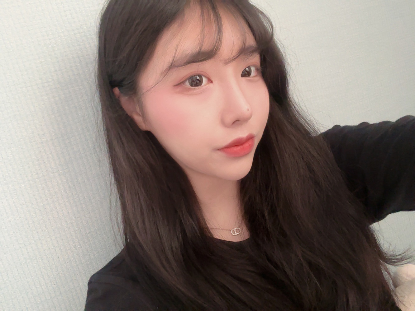 수술후기이미지