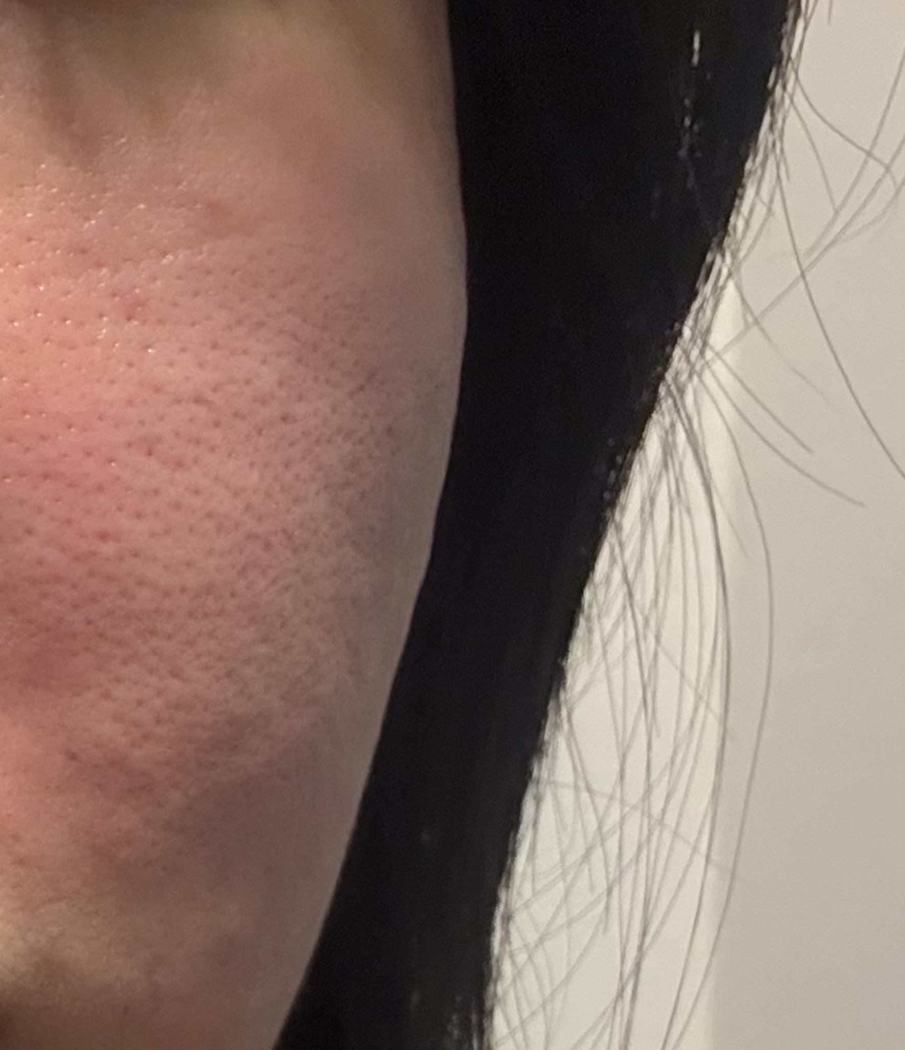 수술후기이미지