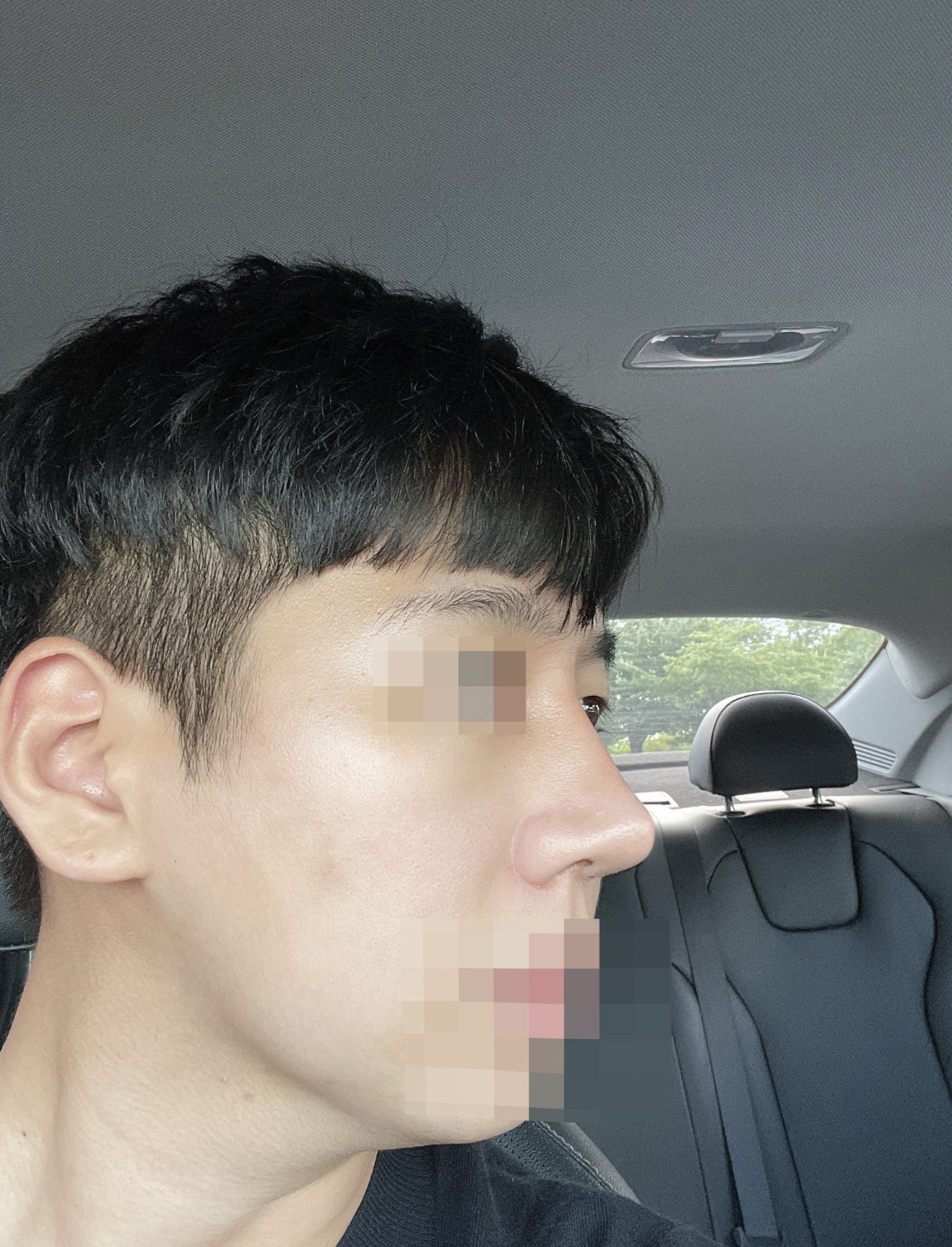 수술후기이미지