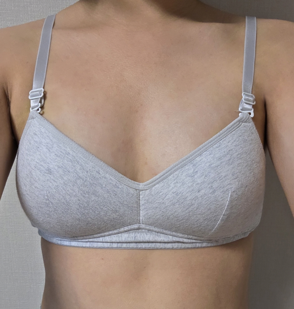 수술후기이미지