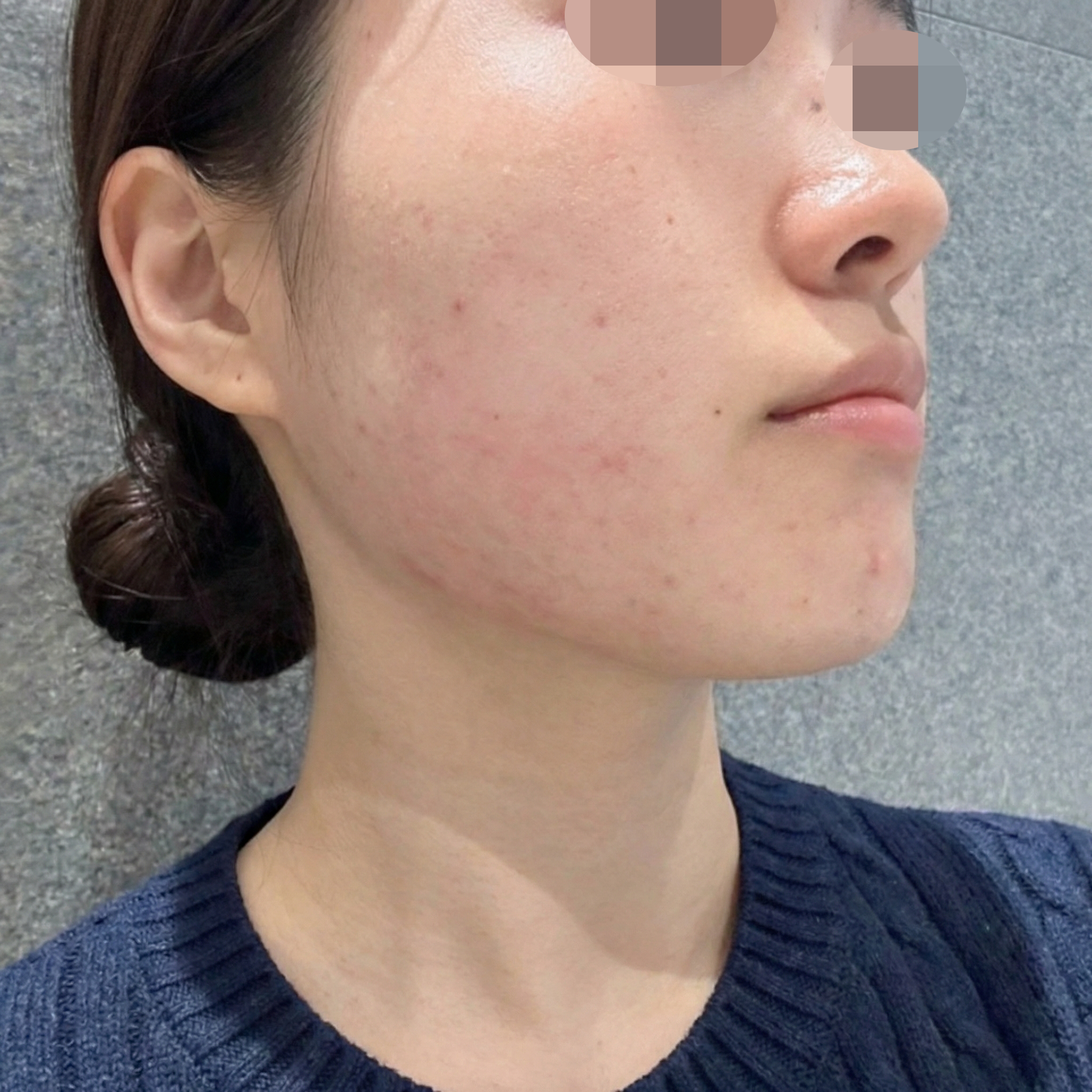 수술후기이미지