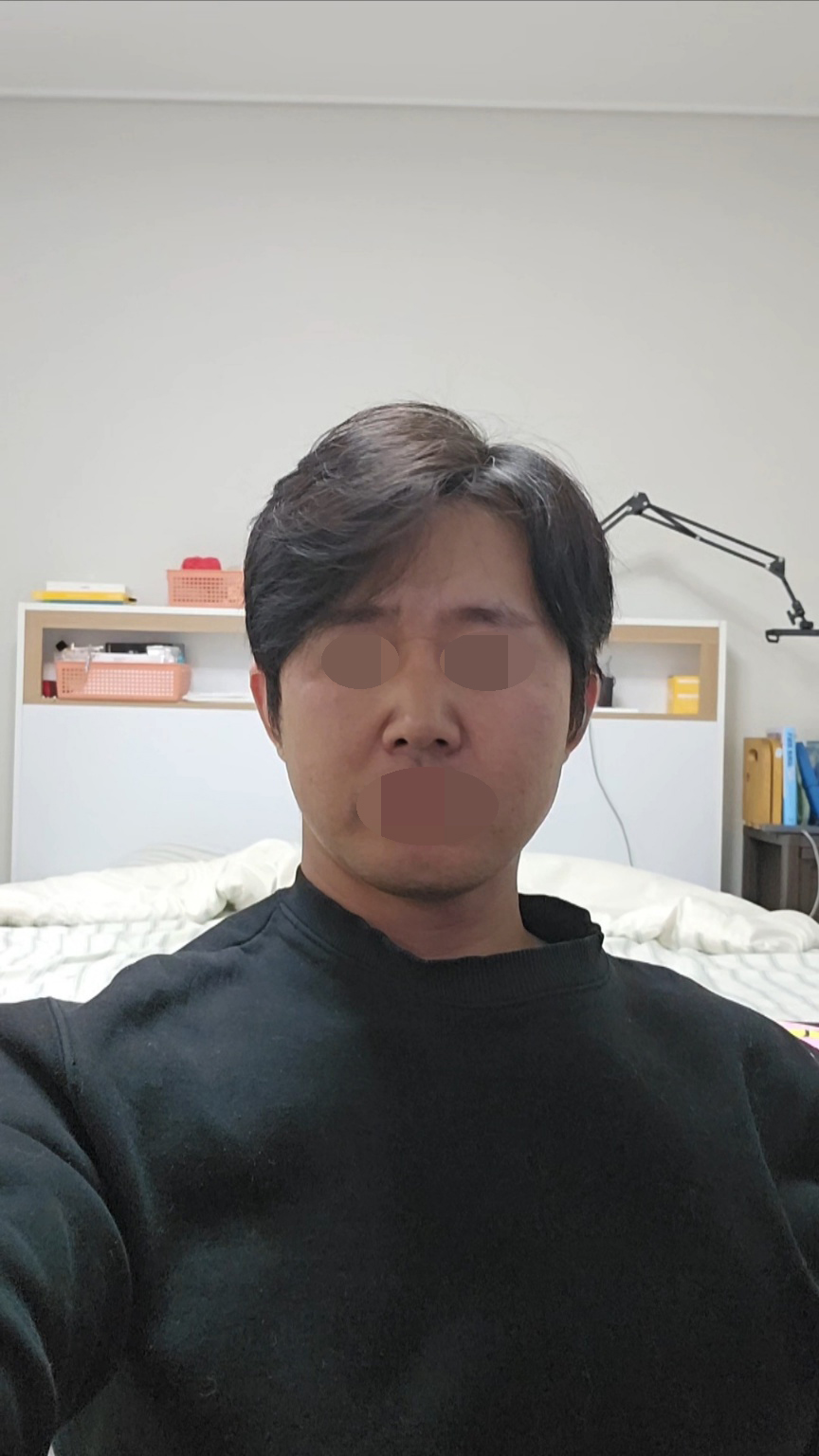 수술후기이미지