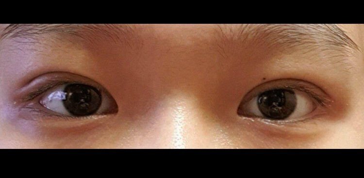 수술후기이미지