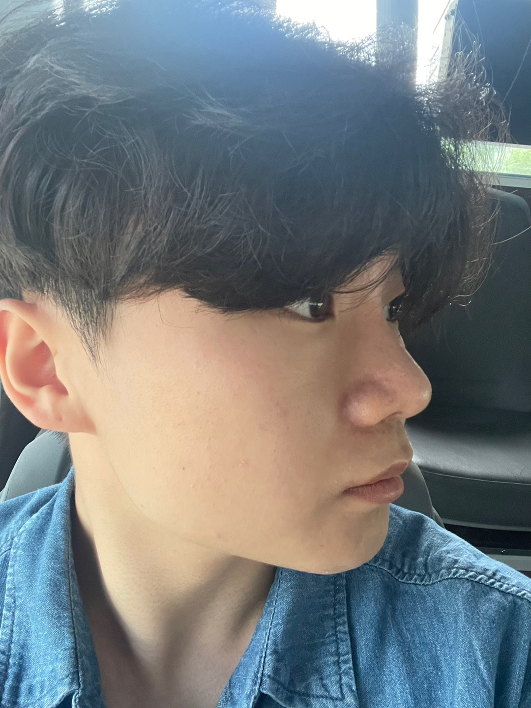 수술후기이미지