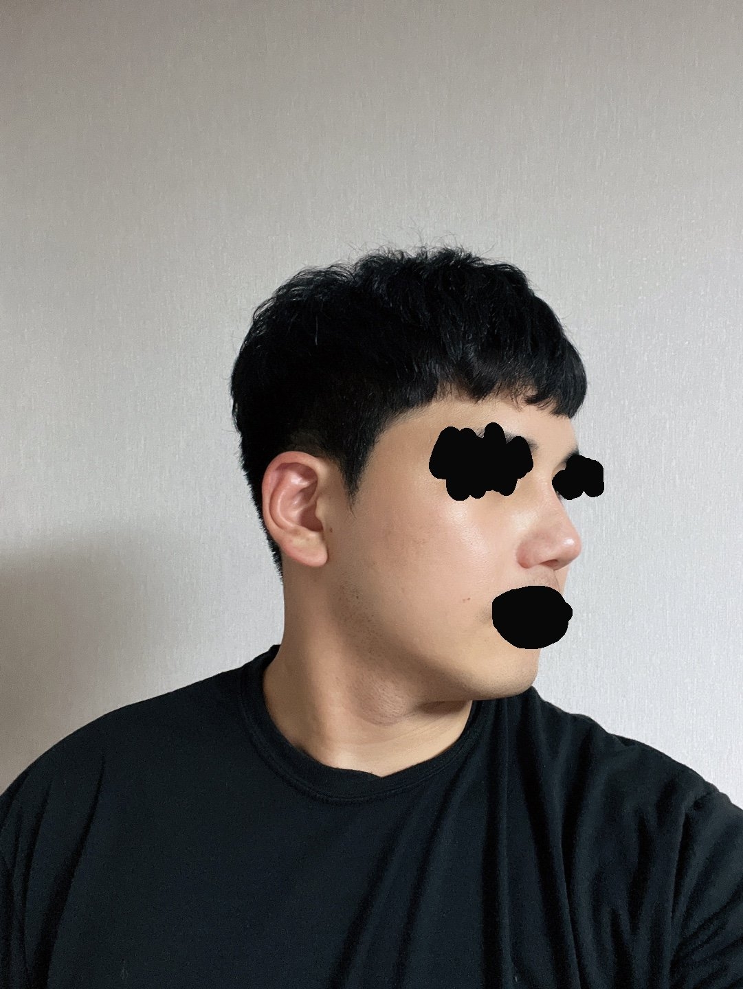 수술후기이미지