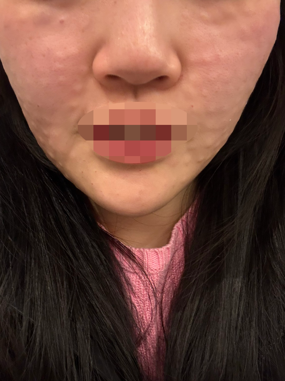 수술후기이미지