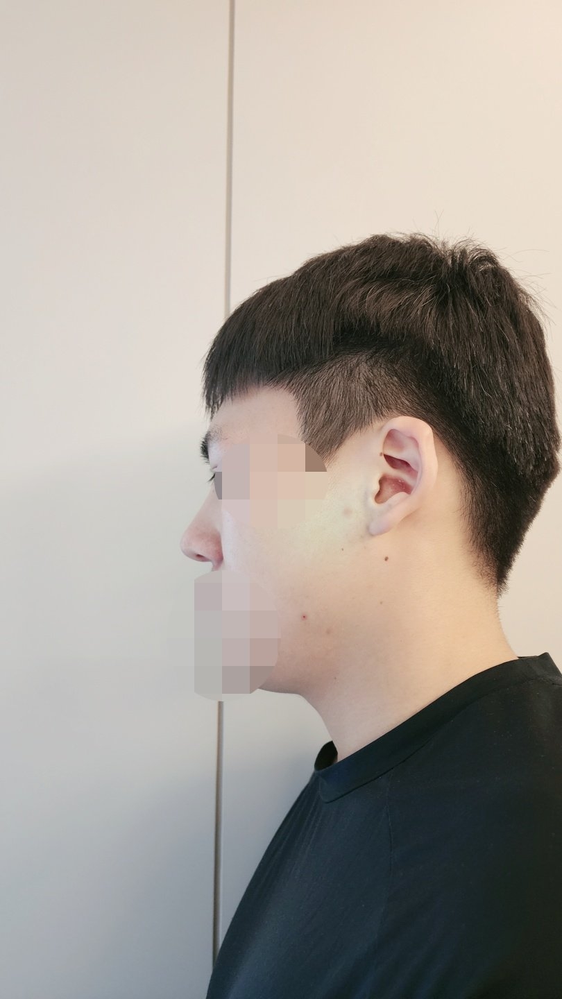 수술후기이미지