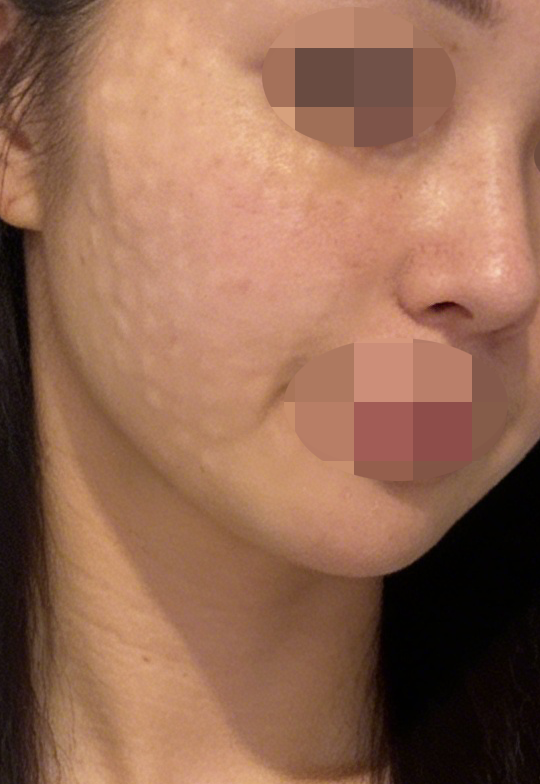 수술후기이미지