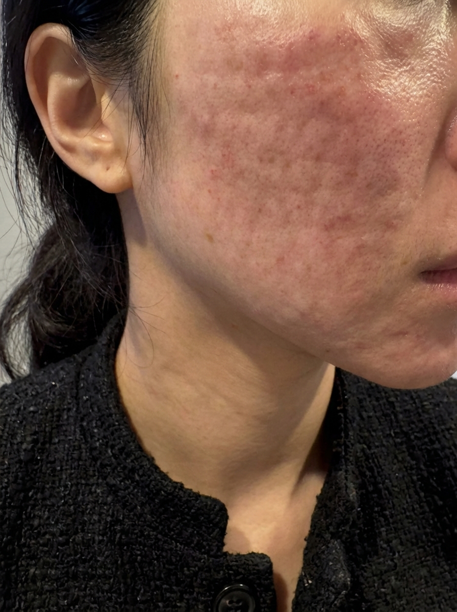 수술후기이미지