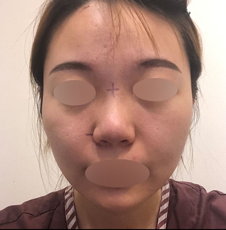 수술후기이미지