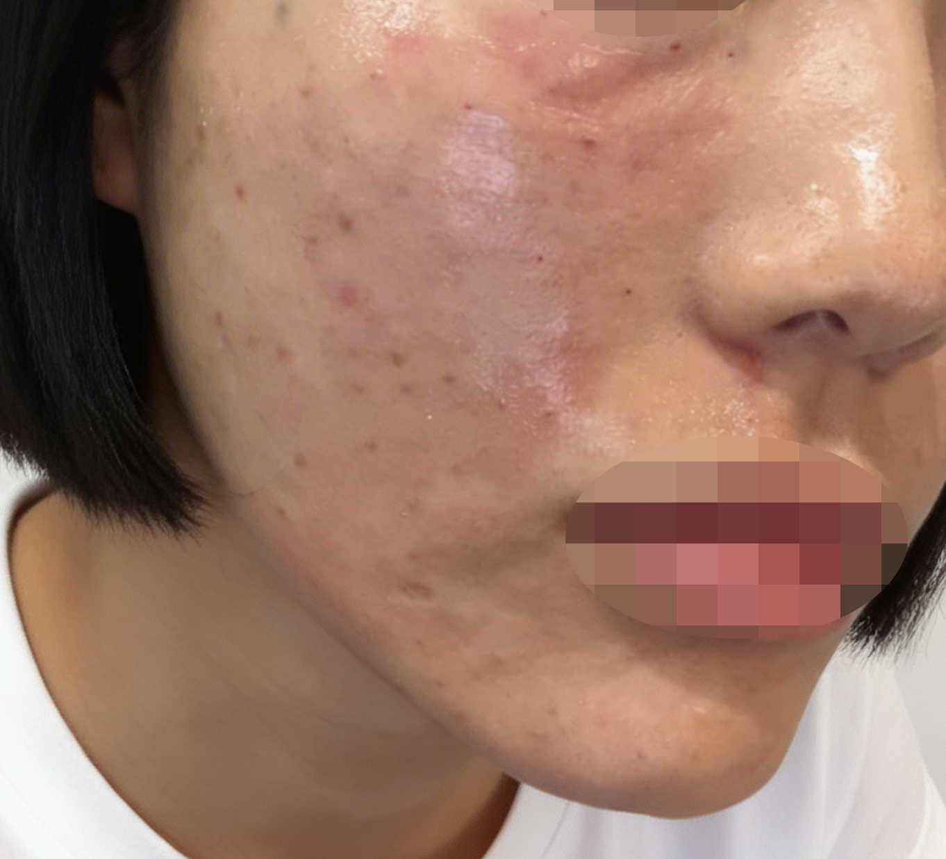 수술후기이미지