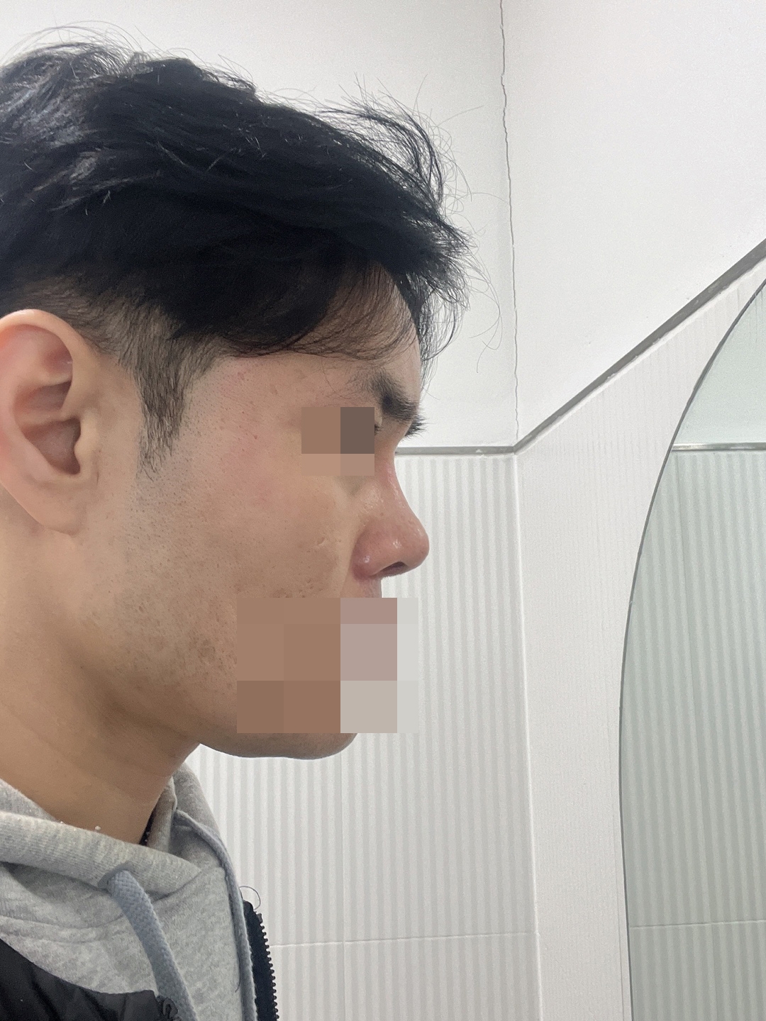 수술후기이미지