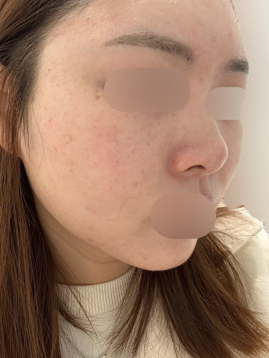 수술후기이미지