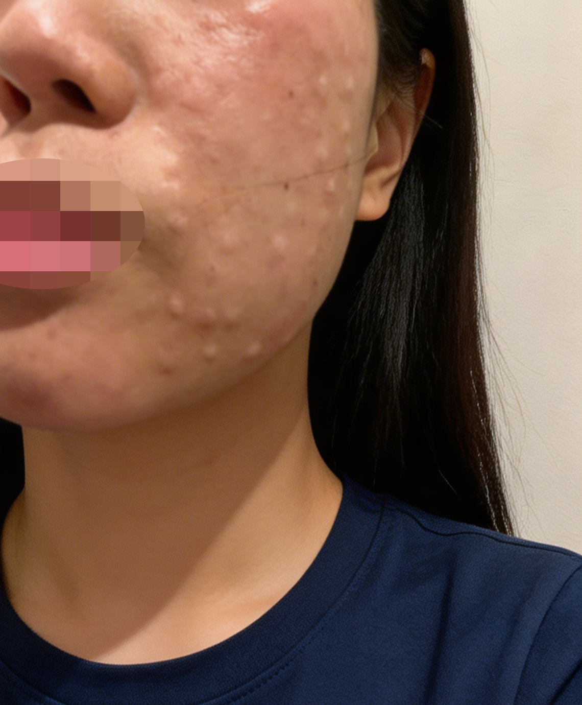 수술후기이미지