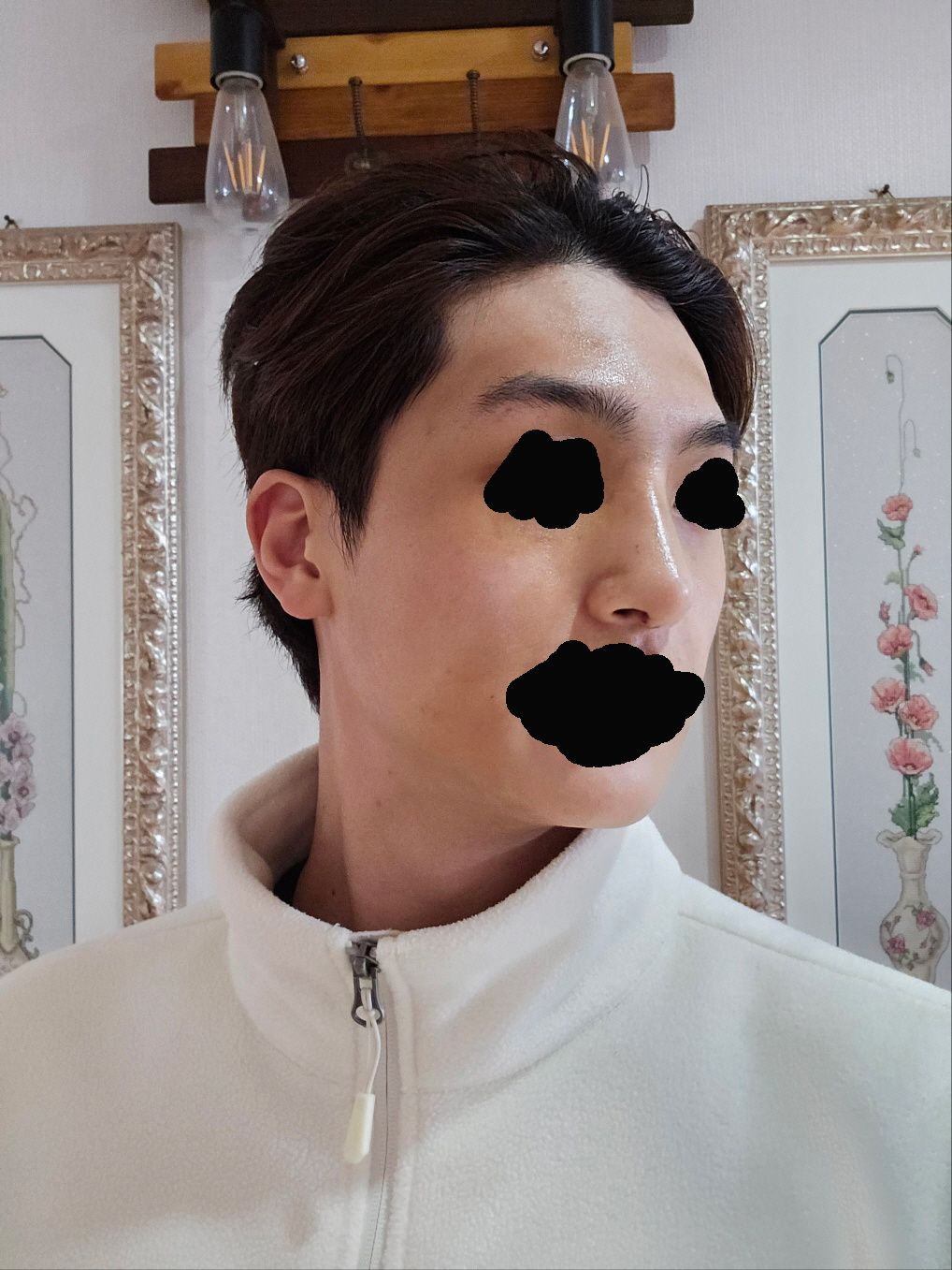 수술후기이미지