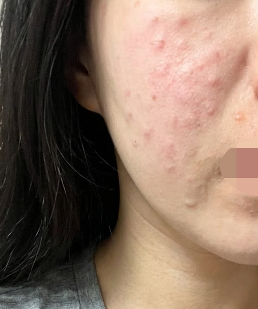 수술후기이미지