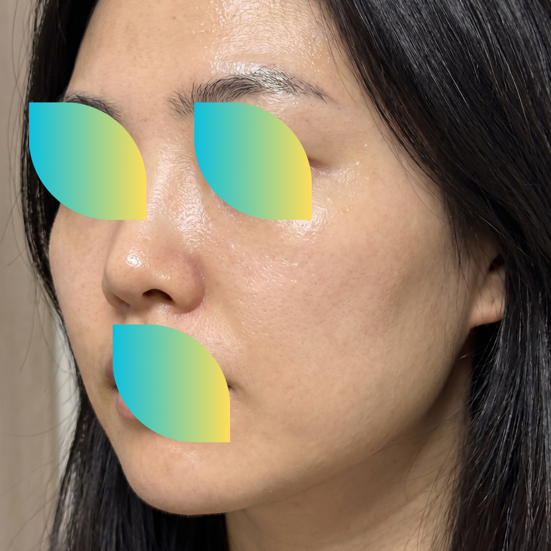 수술후기이미지