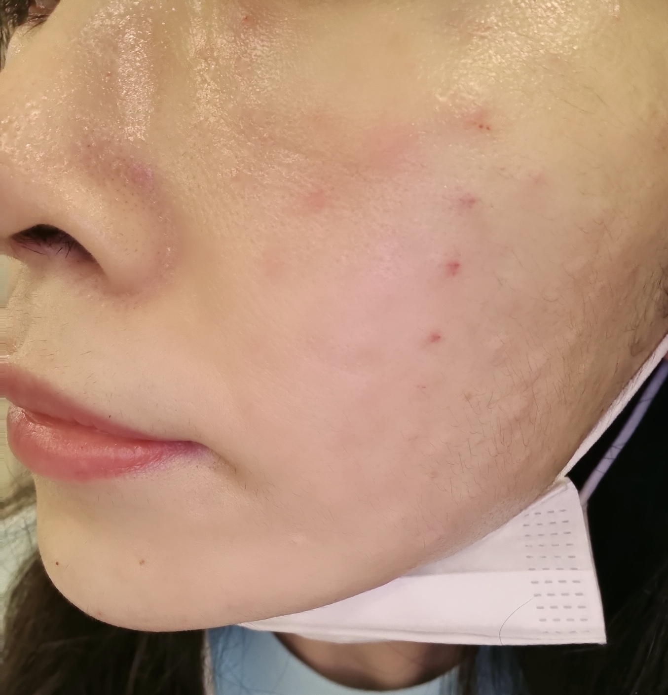 수술후기이미지