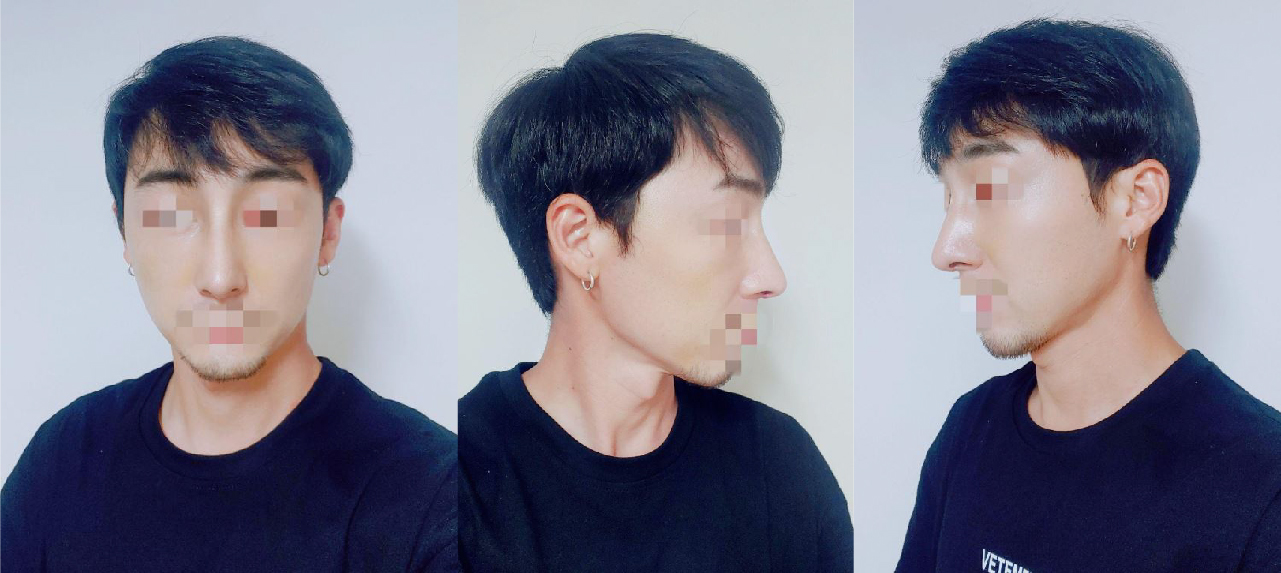 수술후기이미지