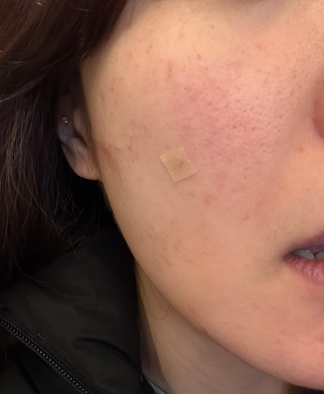 수술후기이미지