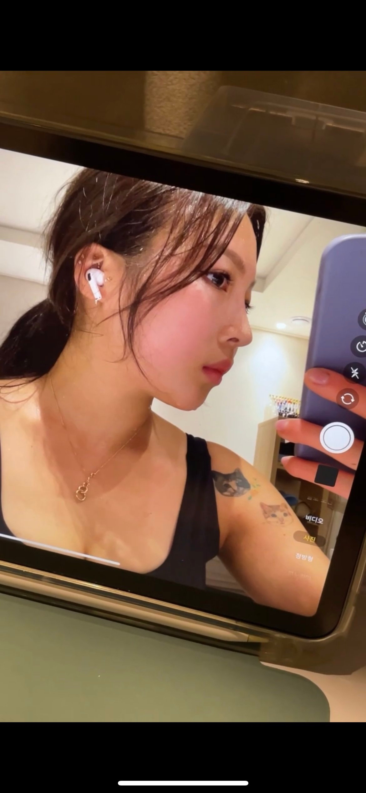 수술후기이미지