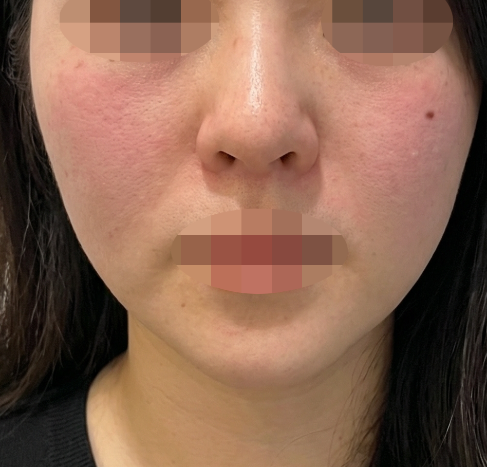 수술후기이미지