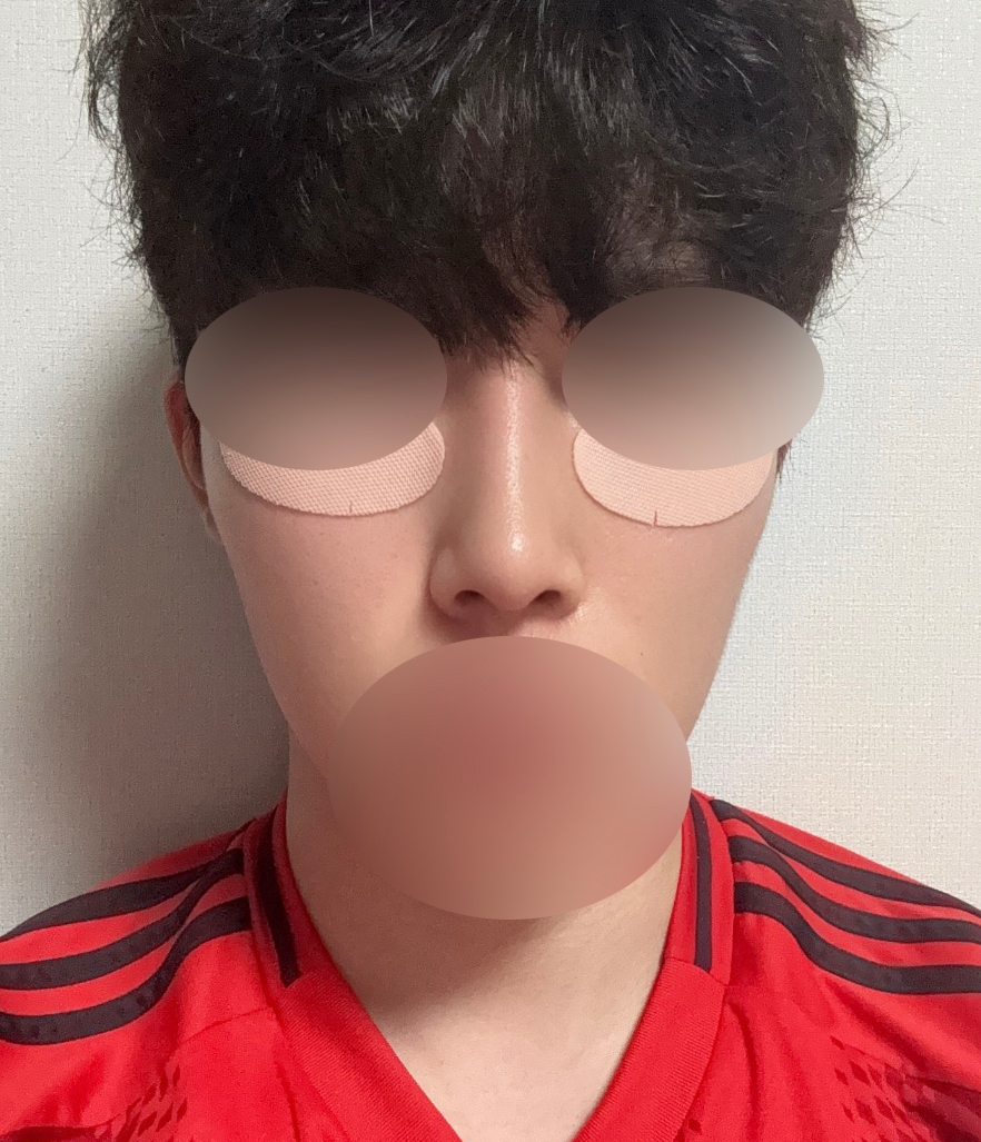 수술후기이미지