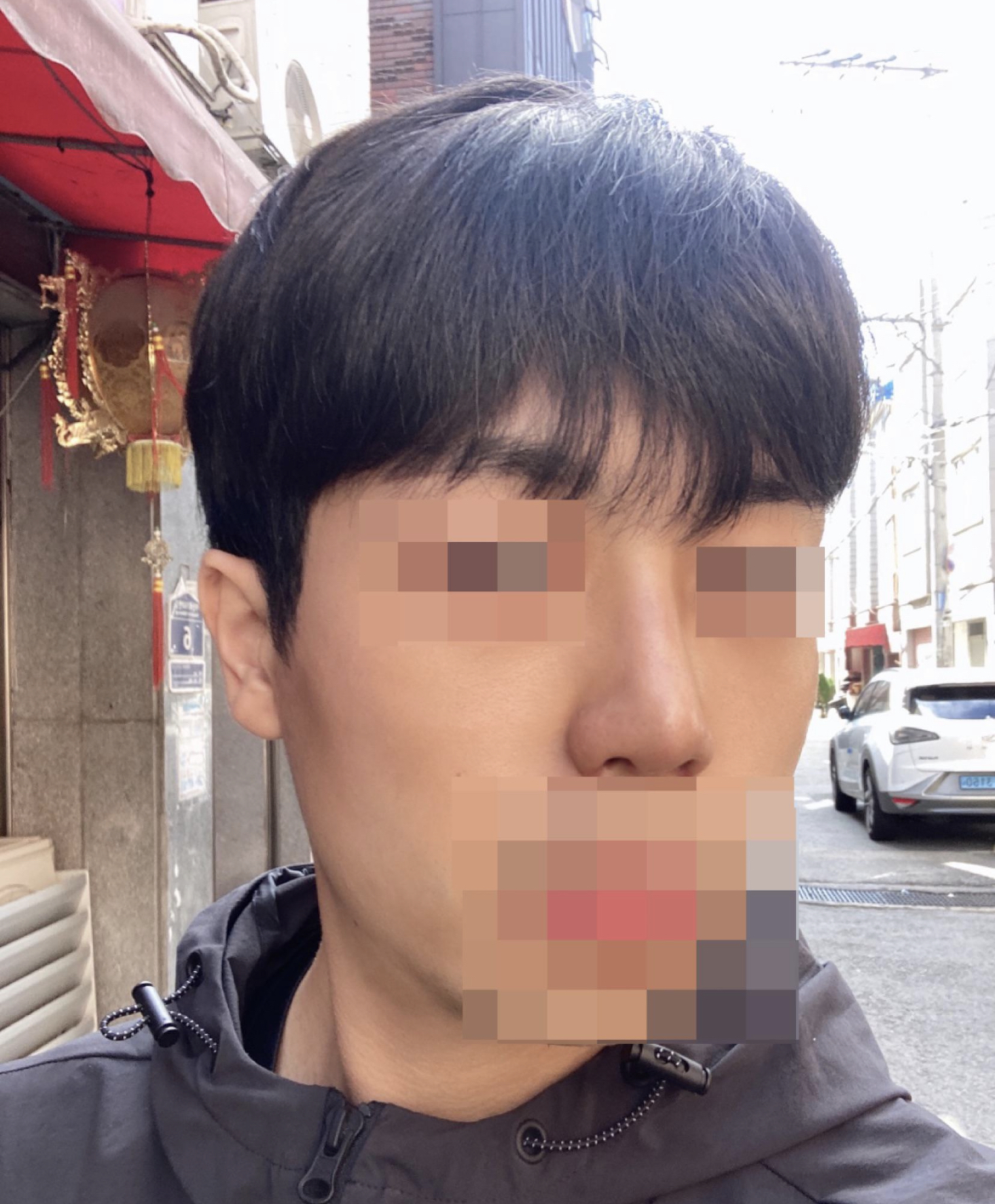 수술후기이미지